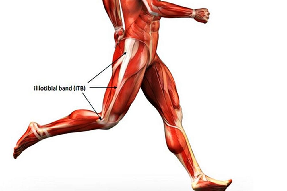 Cách điều trị và khắc phục hội chứng đau dải chậu chày 