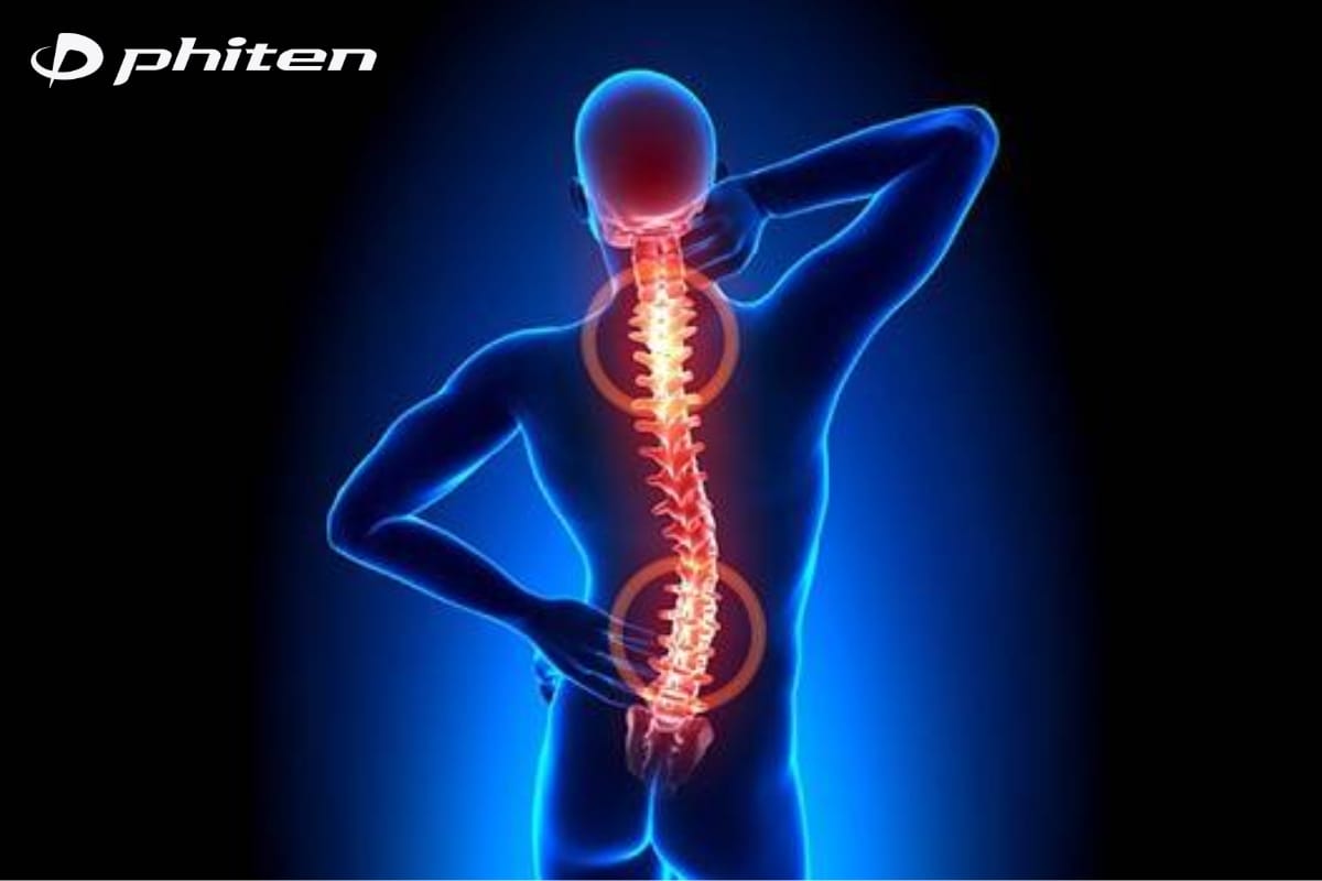 viêm cứng khớp cột sống