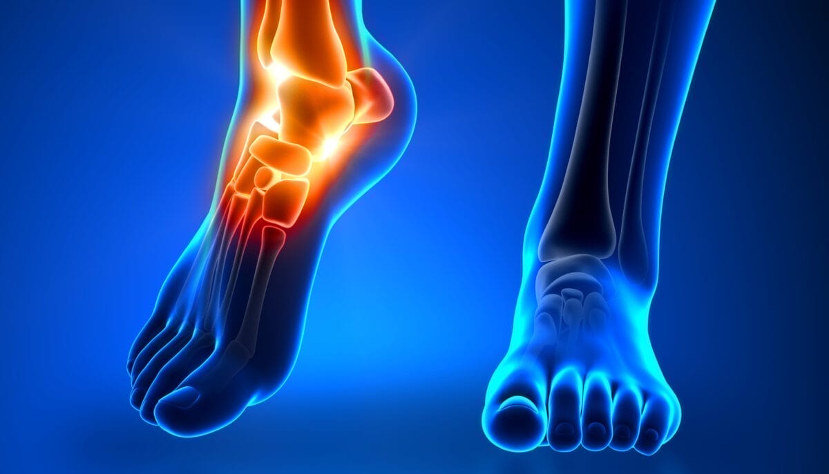 Đau mắt cá chân kinh niên: 5 bài tập giúp tăng sức mạnh và ngăn ngừa chấn  thương