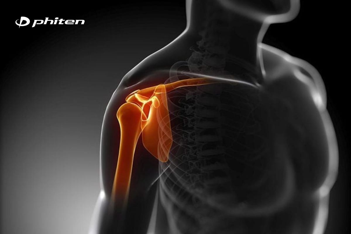 hội chứng rotator cuff