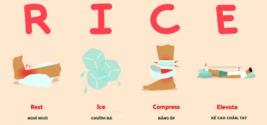 R I C E Phương pháp sơ cứu chấn thương hiệu quả