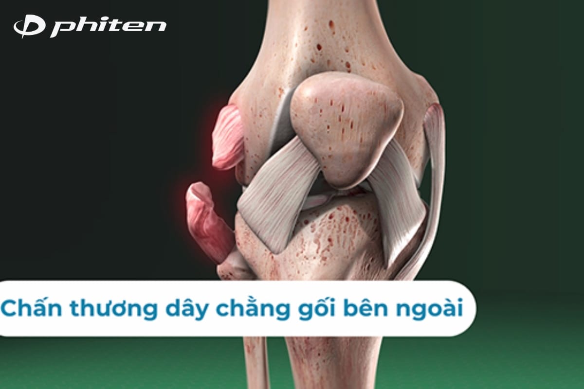 tại sao bị đau đầu gối khi chơi thể theo