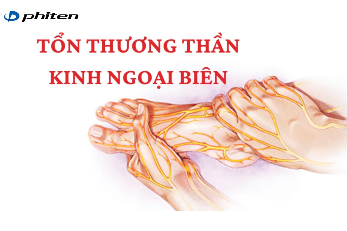 Tổn thương thần kinh ngoại biên